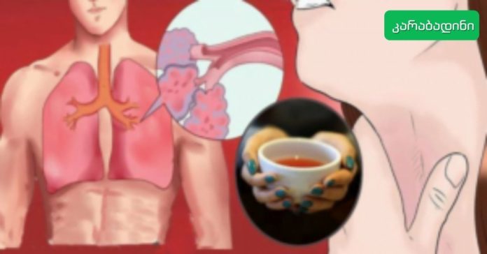 კარაბადინი - 2022-05-10T143851.328