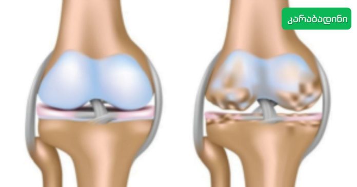 კარაბადინი - 2022-06-14T120408.613