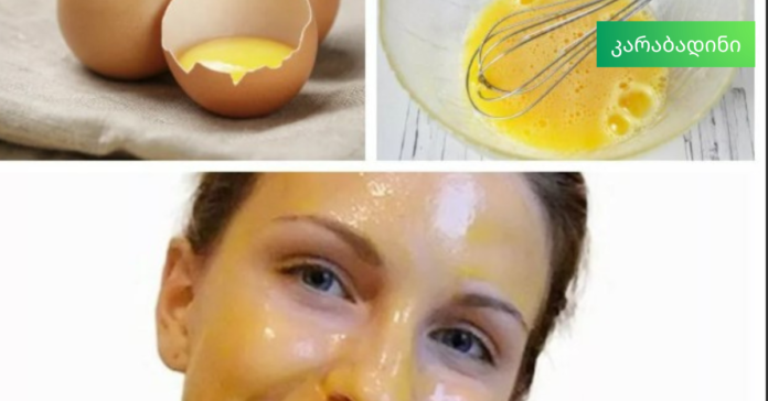 კარაბადინი (39)